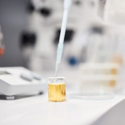 Science, tube and research in lab with liquid, medicine or pharma product on desk for chemical anal